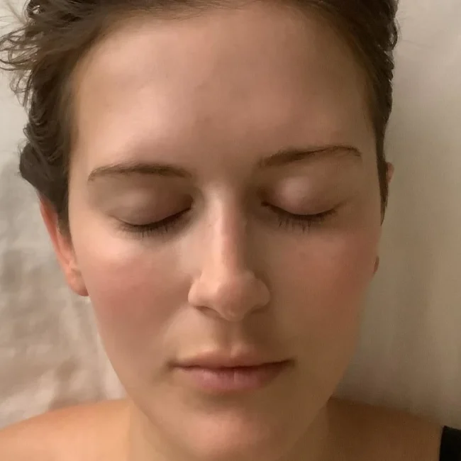 Biologique Recherche Facial before