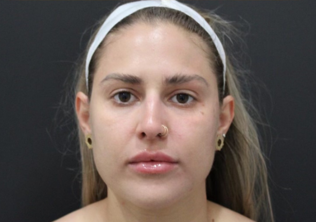 Medical Facial after