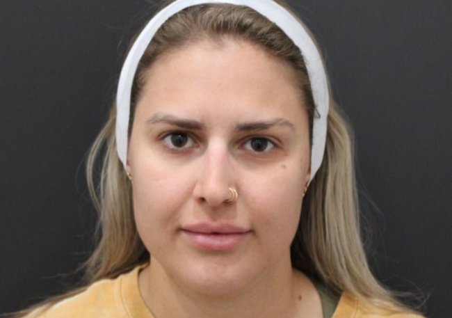 Medical Facial before