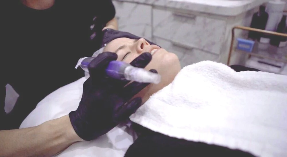 Everything You Need To Know About Microneedling