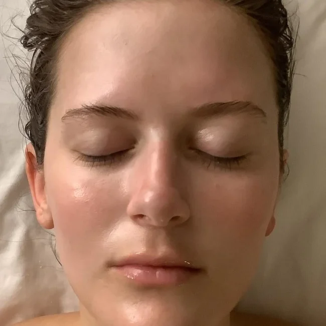 Biologique Recherche Facial after
